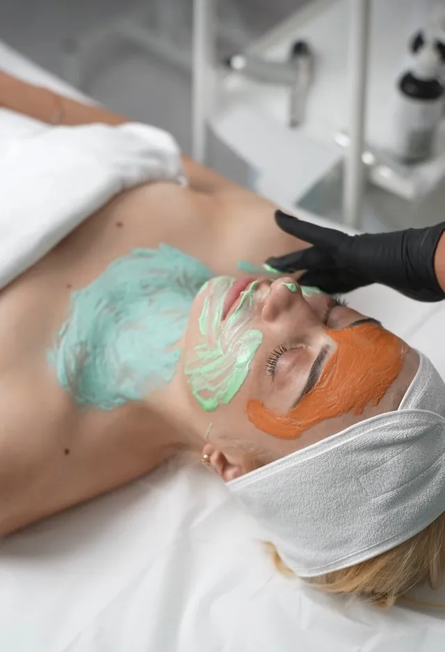 Chemical peel - Hope Centar Beograd