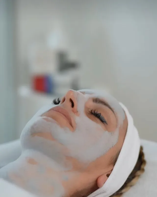 Acne treatment - Hope Centar Beograd